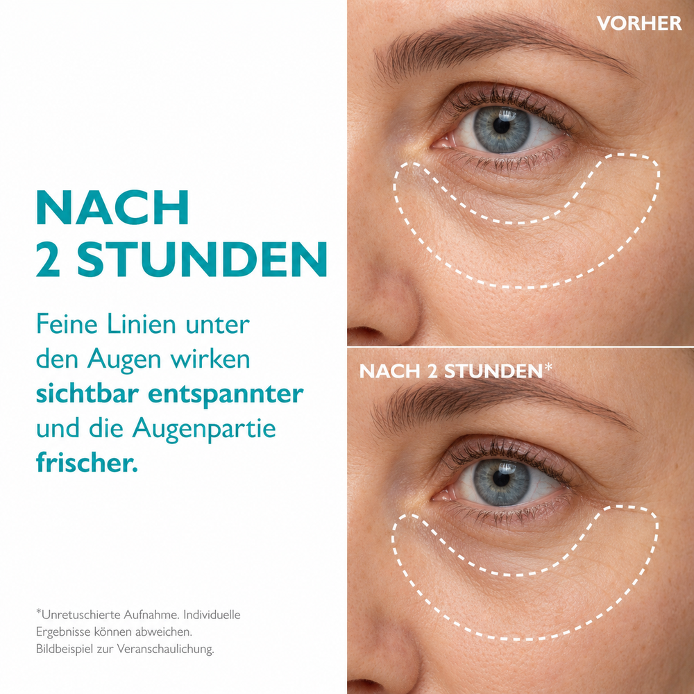 Lunéa - Peptid Anti-Falten Patches