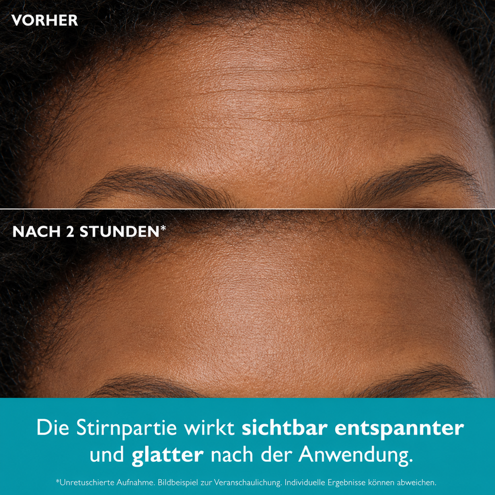 Lunéa - Peptid Anti-Falten Patches