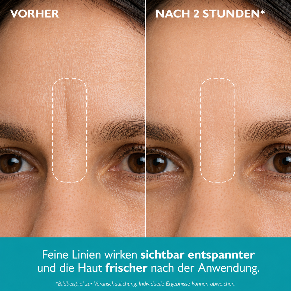 Lunéa - Peptid Anti-Falten Patches
